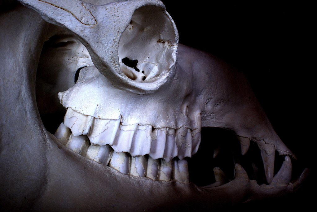 Understanding More About Dental Implants, Including Their Advantages