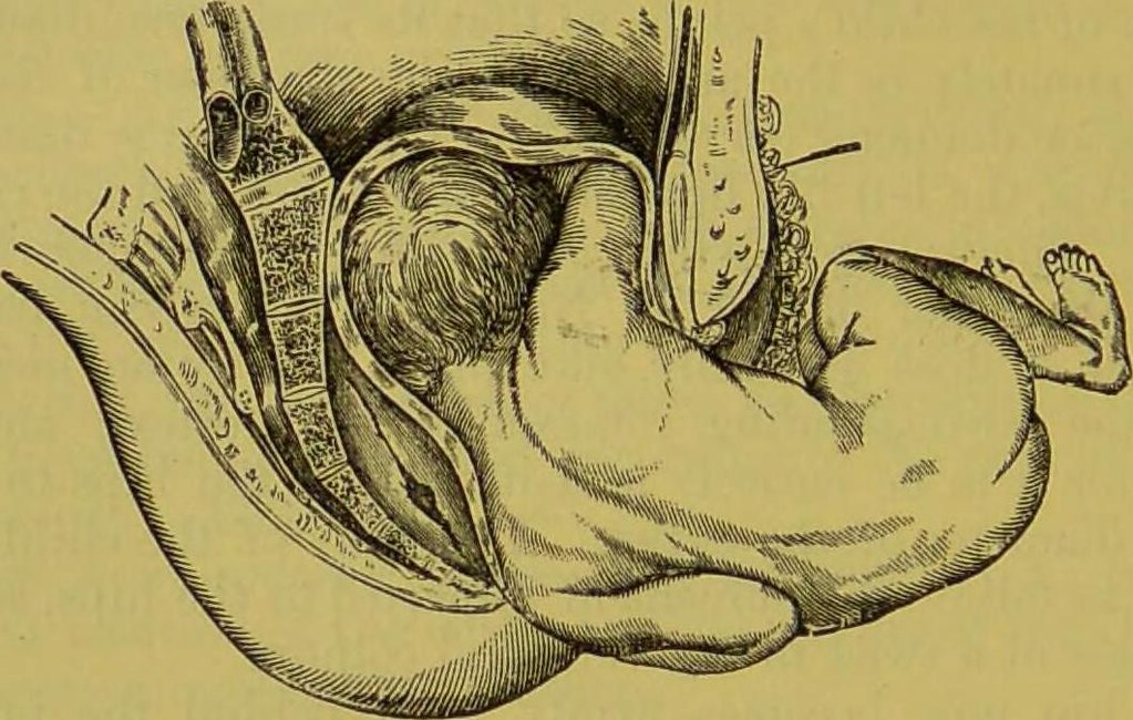 What You Should Know About Midwifery