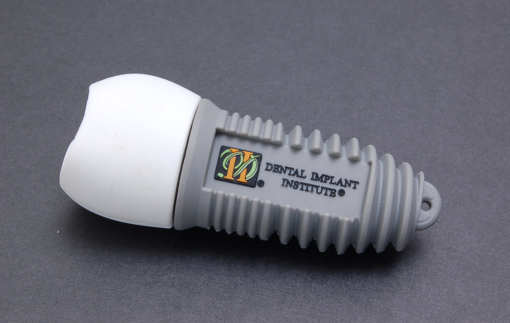 All You Need to Know About Dental Implants