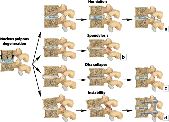 The leading causes of joint pain