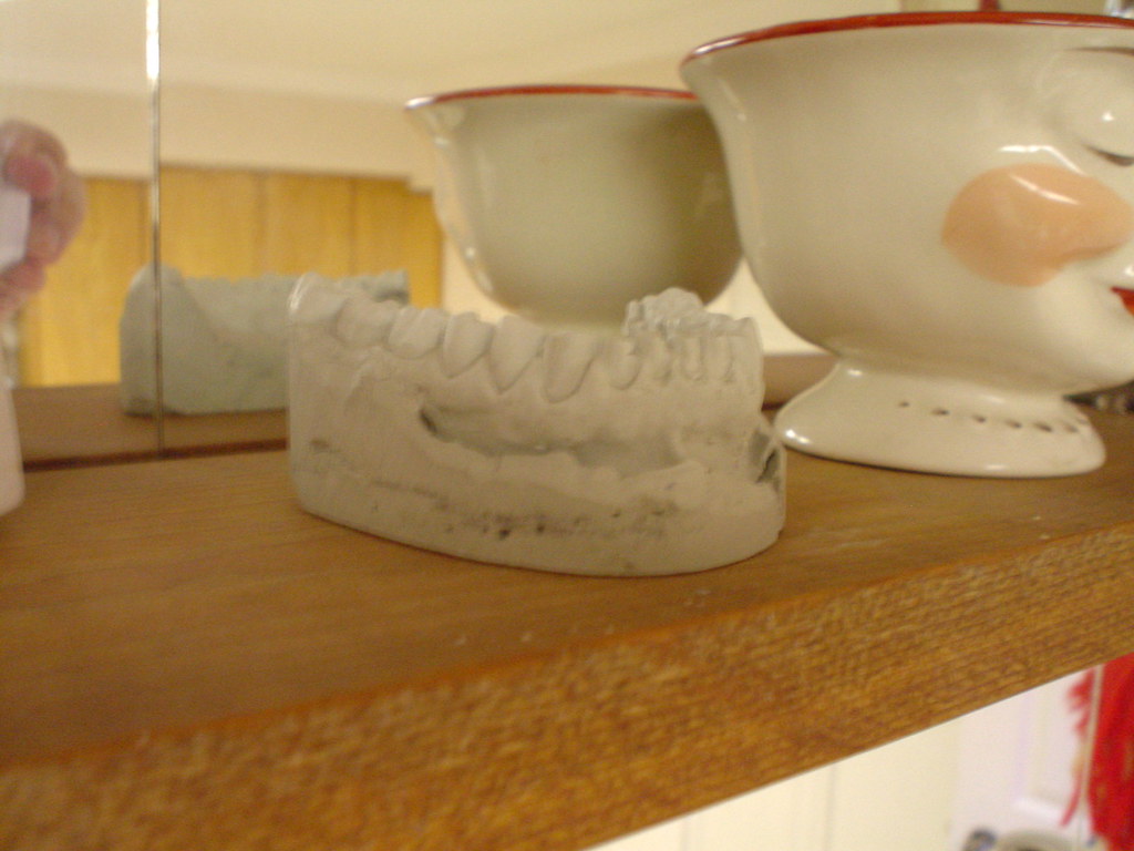Dental Veneers: Minimally Invasive Cosmetic Dentistry at Its Best